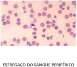 Imagem da questão