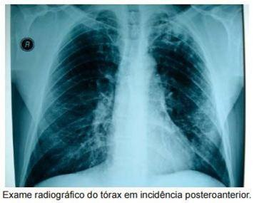 Imagem da questão