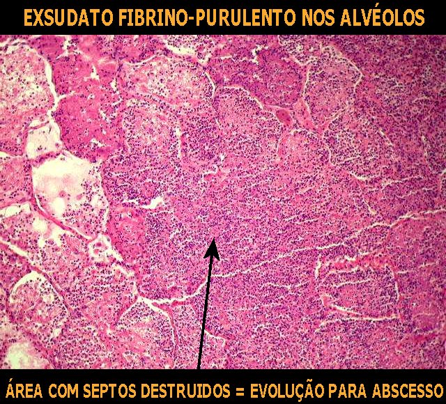 Imagem da questão