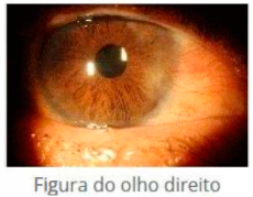 Imagem da questão