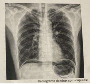 Imagem da questão