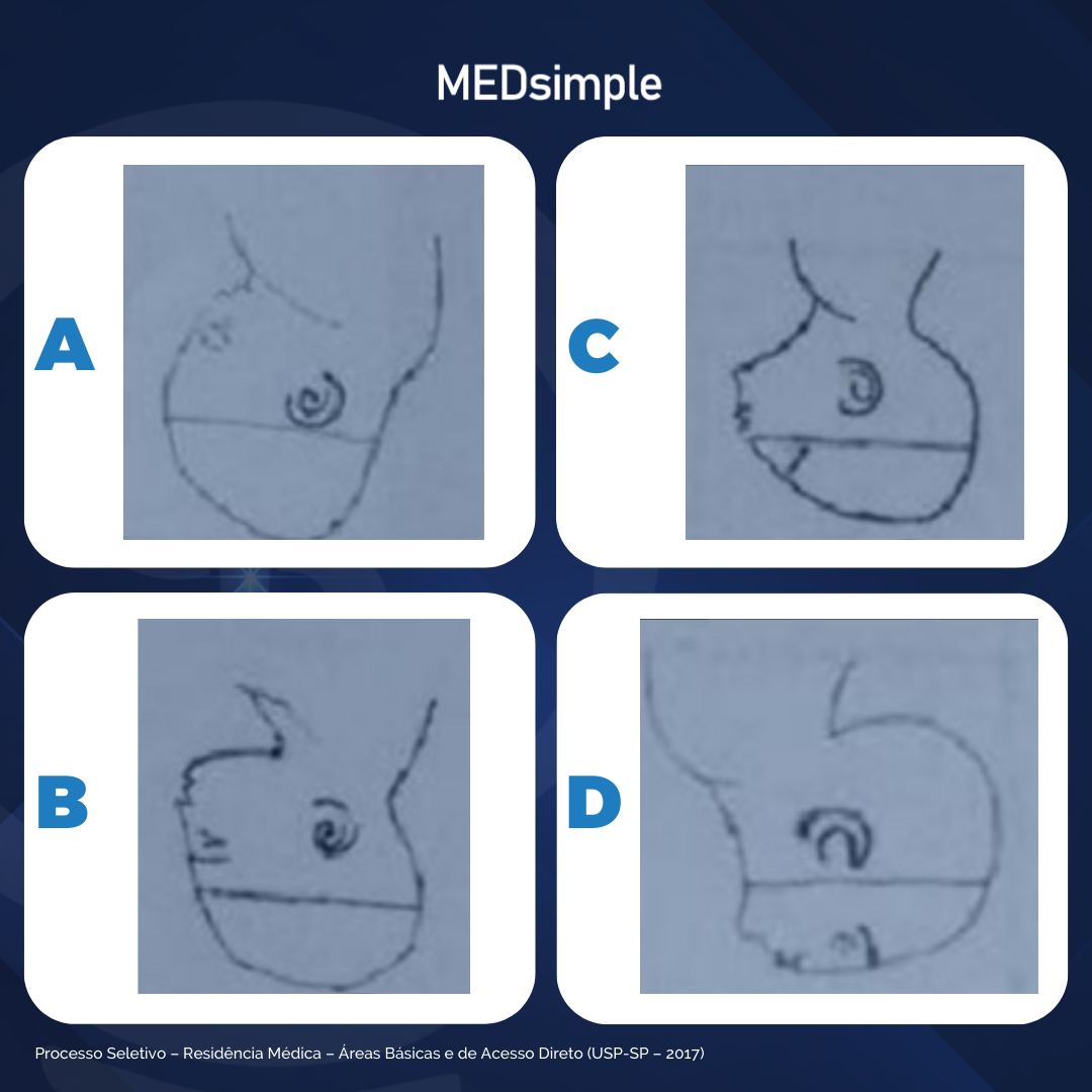 Imagem da questão