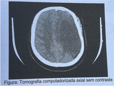 Imagem da questão
