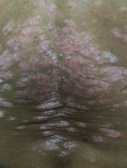 Imagem da questão