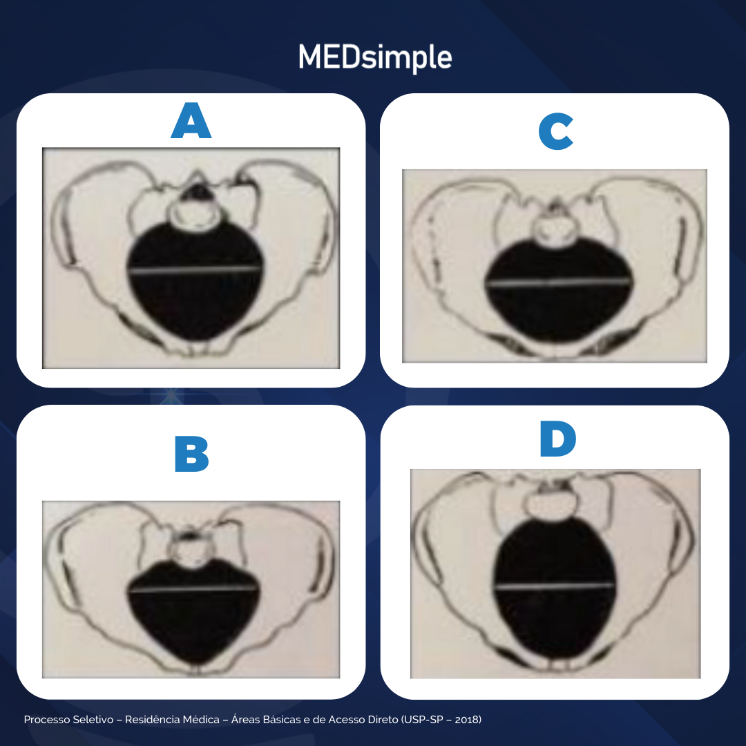 Imagem da questão