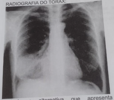 Imagem da questão