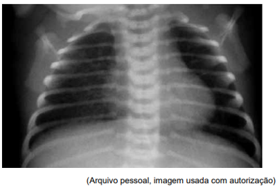 Imagem da questão