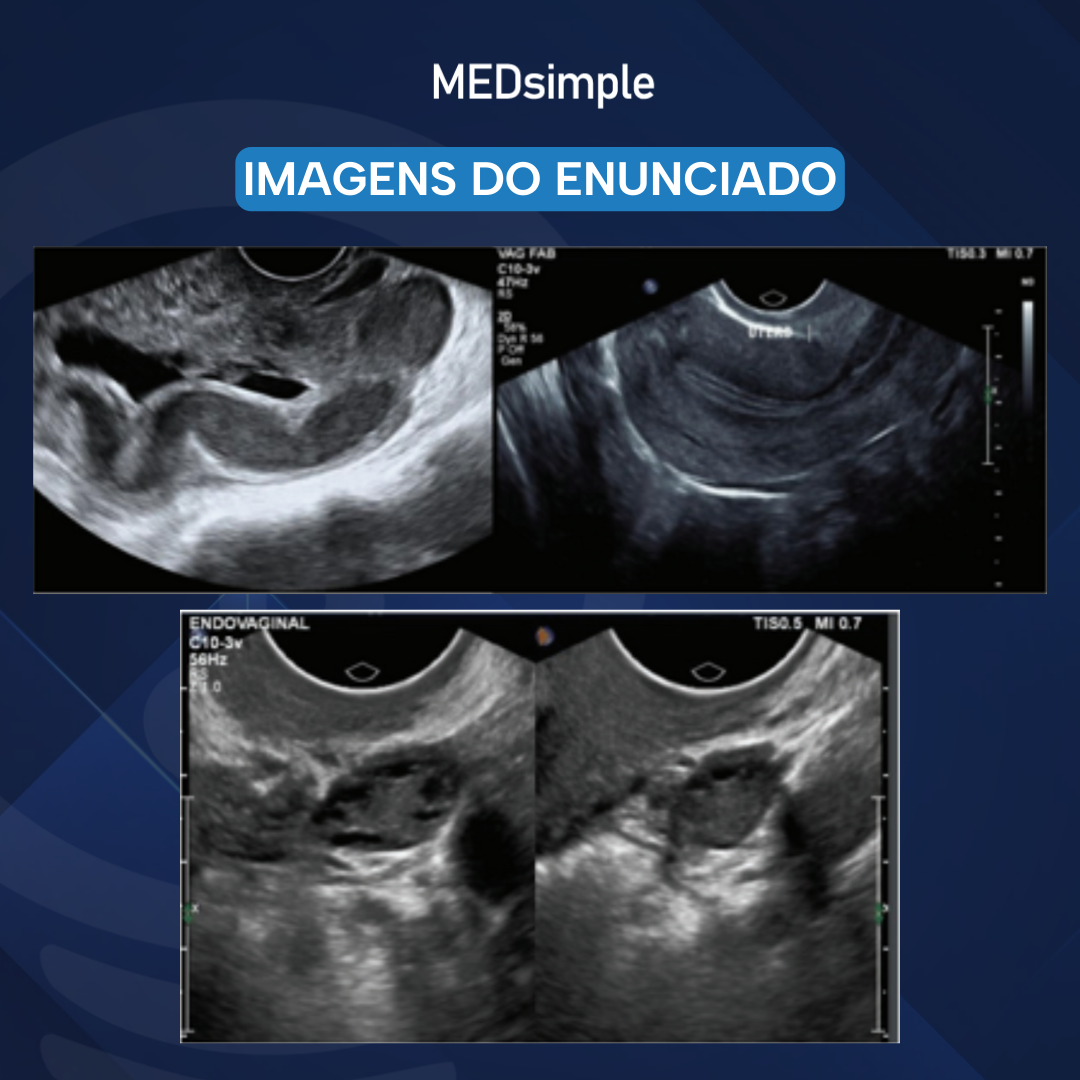 Imagem da questão